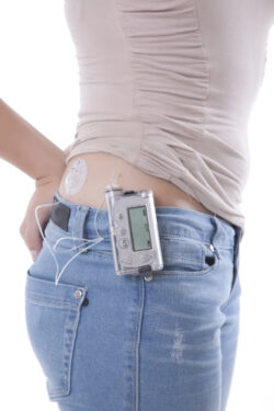 Young girl with insulin pump